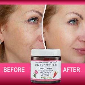 4-Ageing-Skin-before-after-120.jpg