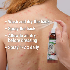 back-acne-instructions-with-girl-2.jpg