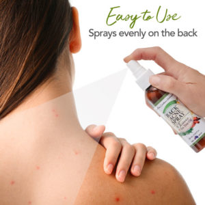back-acne-spray-web-4